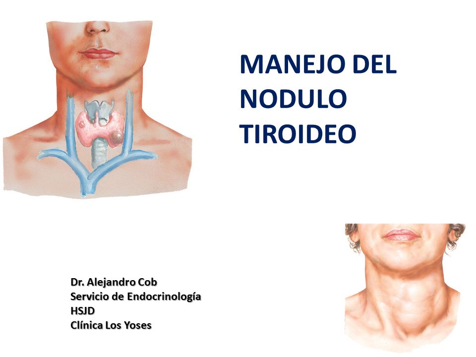 NODULO TIROIDEO EPUB DOWNLOAD NODULO TIROIDEO EPUB DOWNLOAD